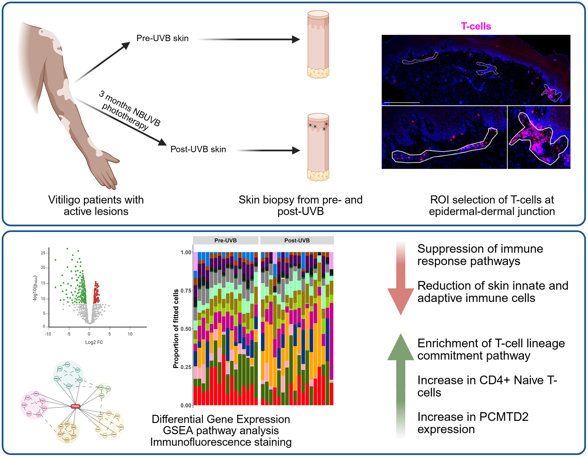 Graphical abstract showing vitiligo lesions before and after NB-UVB treatment, skin biopsy and T-cell region-of-interest selection, followed by spatial transcriptomic analysis and reduced inflammatory immune programs.